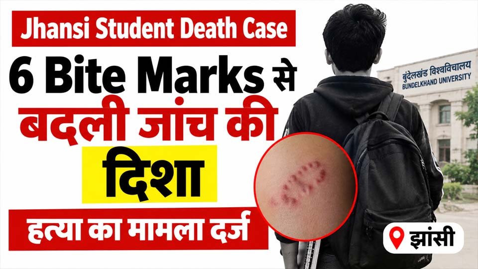 Jhansi Student Death Case: 6 Bite Marks से बदली जांच की दिशा, हत्या का मामला दर्ज